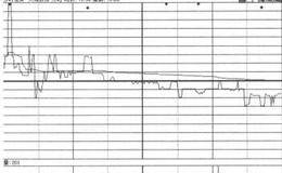 分时走势第12招：旗形出货的概述解析