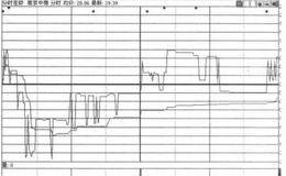 分时走势13招：心电图形出货的表述解读