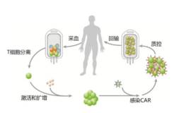 CAR-T治疗全球受关注,CAR-T治疗题材概念股可关注