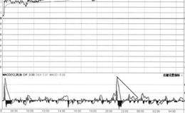 MACD值超买后高位横盘修整+锯齿变盘区域的图形分析