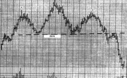 <em>股市趋势技术分析</em>突破颈线形态