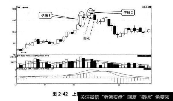 图2-42上海机电孕线形态