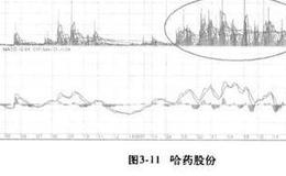 <em>青岛海尔</em>股票实例分析？哈药股份股票分析？